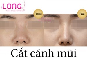 cat-canh-mui-thuc-hien-nhu-the-nao-1