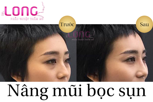 sun-nhan-tao-co-nang-mui-vinh-vien-duoc-khong-1