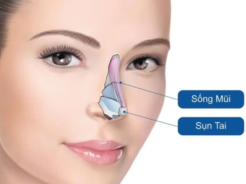 nang-mui-cau-truc-sun-tai12