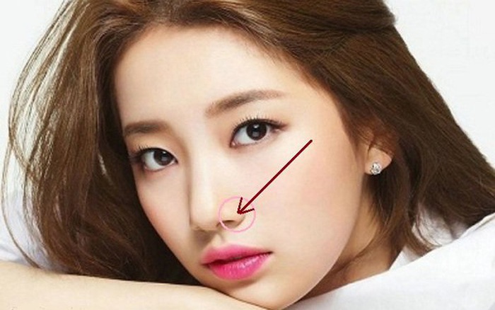 cắt cánh mũi có mất lộc không