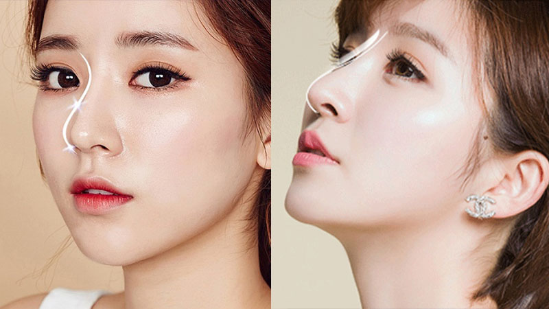 nâng mũi sau bao lâu thì vào form