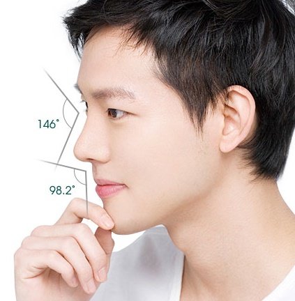 Nâng sống mũi nam giới